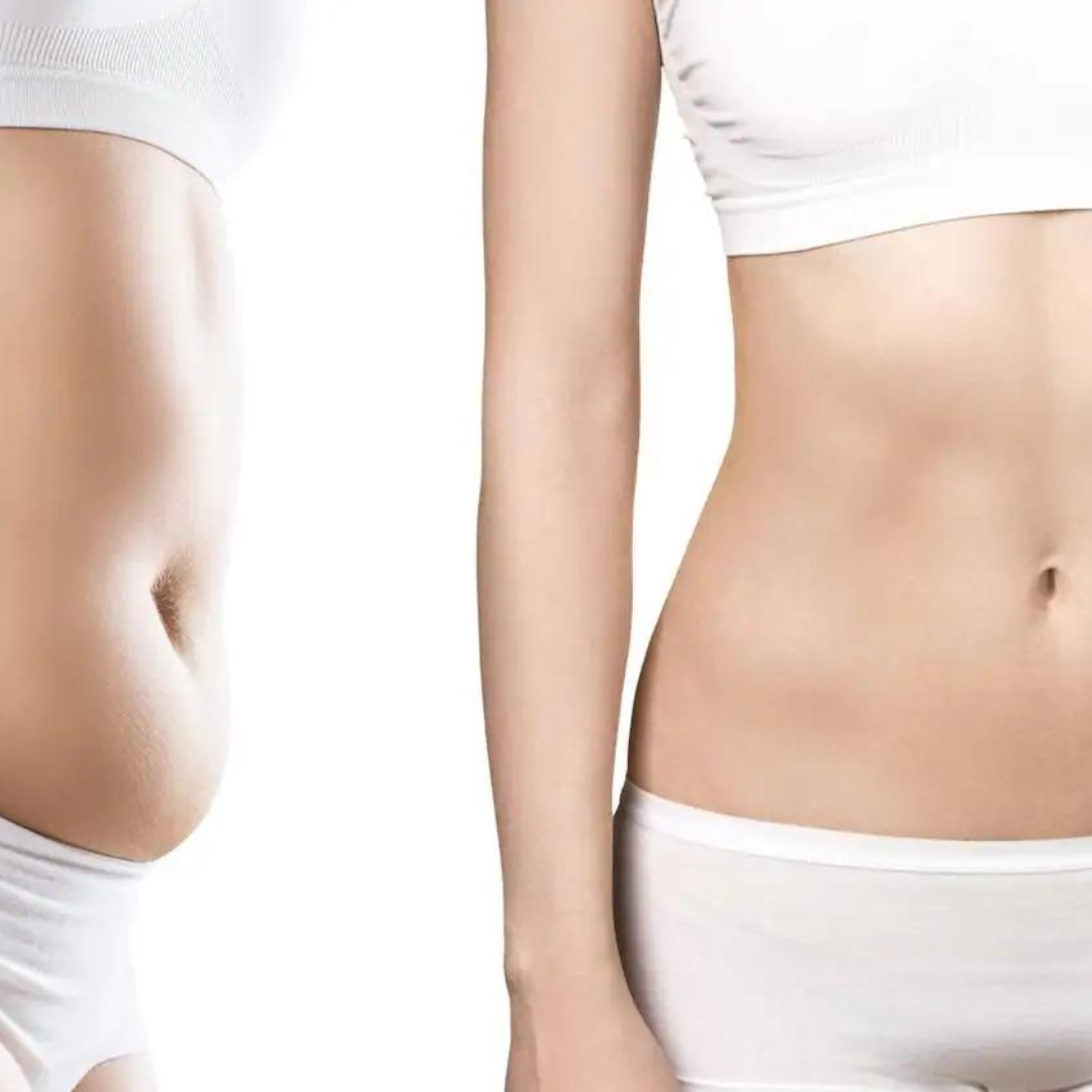 Té Slimming Tea